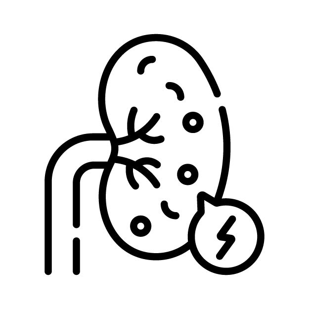 Kidney, Uretric Stone Disease