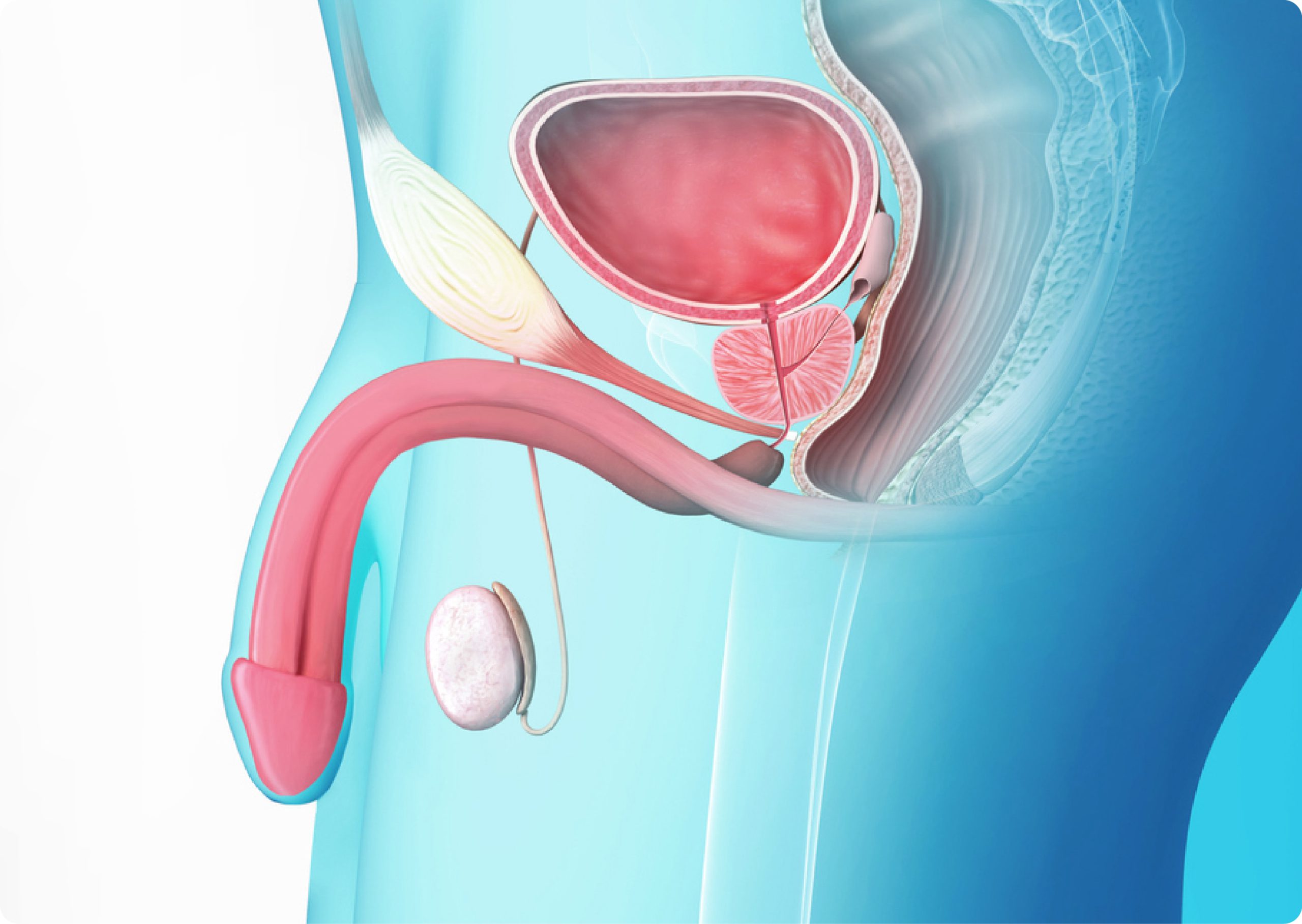 Urethral Stricture