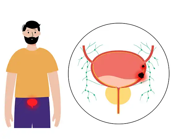 Practice hygienic intimate practices: Urethritis in men can be distressing