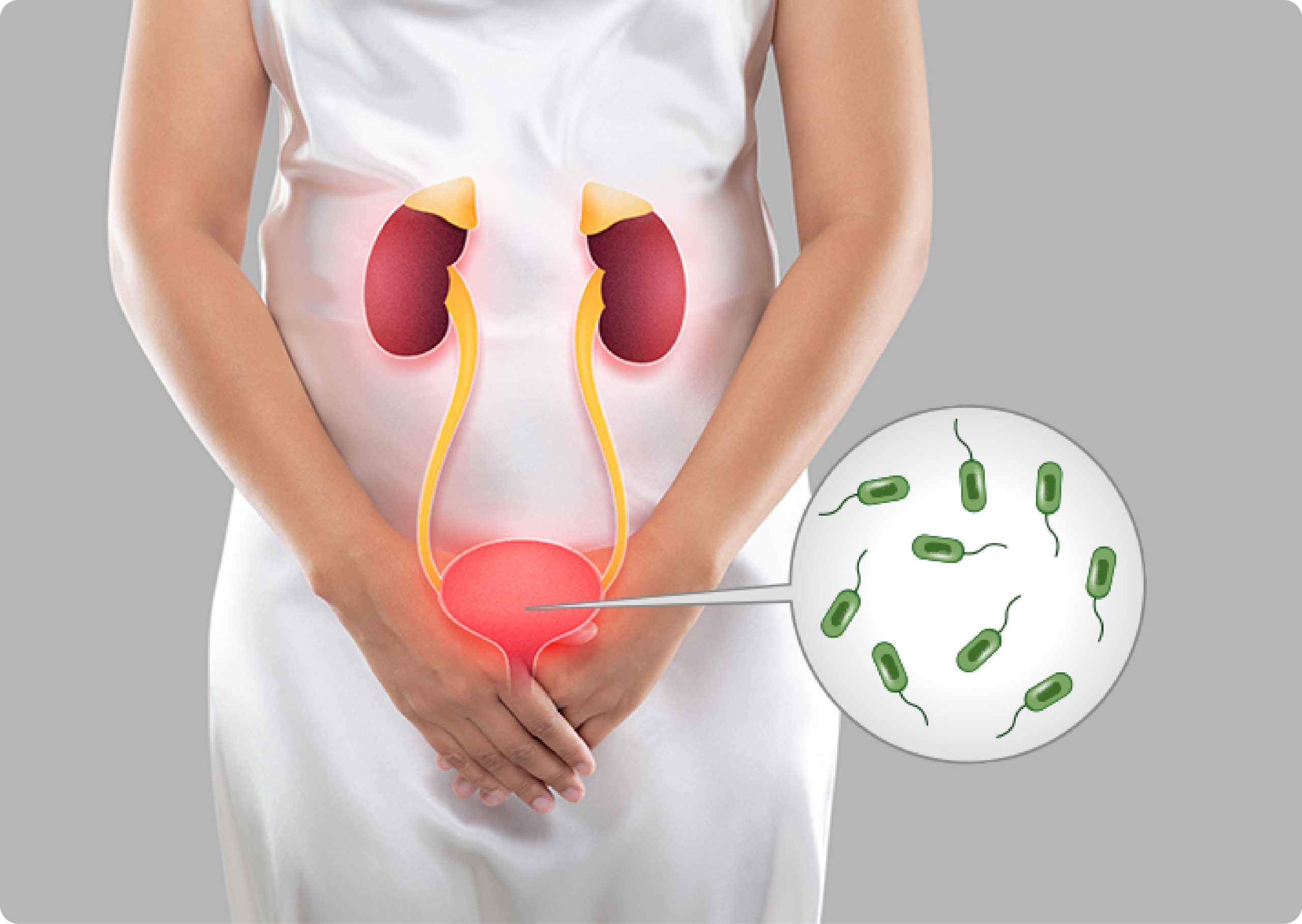 Urinary Tract Infection