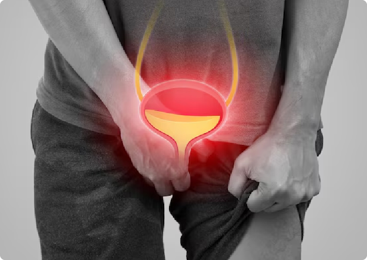 Prostate Cancer